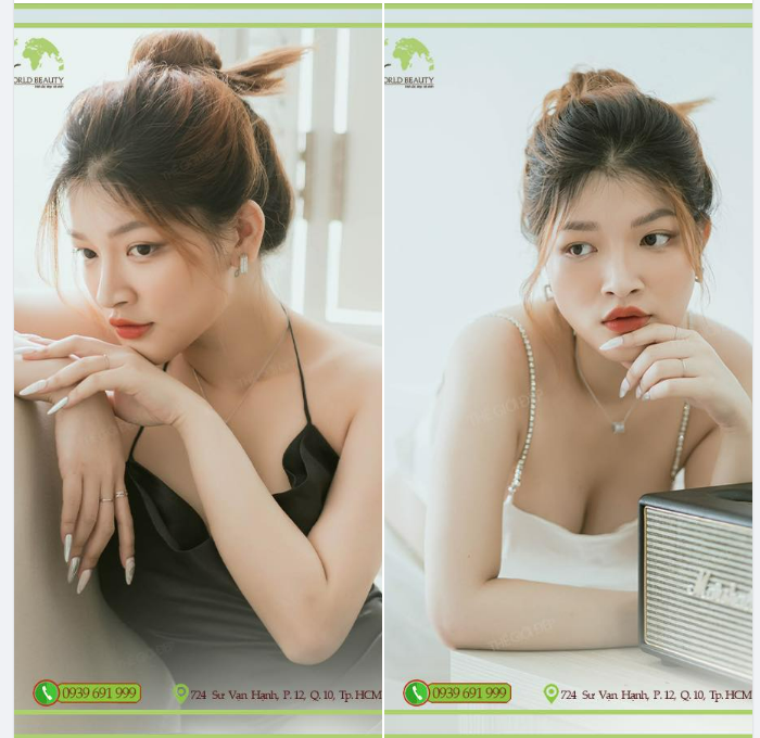 Bằng bộ 3 phẫu thuật, Thế Giới Đẹp đã mang lại cho quý Cô sự thay đổi hoàn toàn, L.ỘT X.ÁC toàn diện từ hình thể đến dung mạọ: