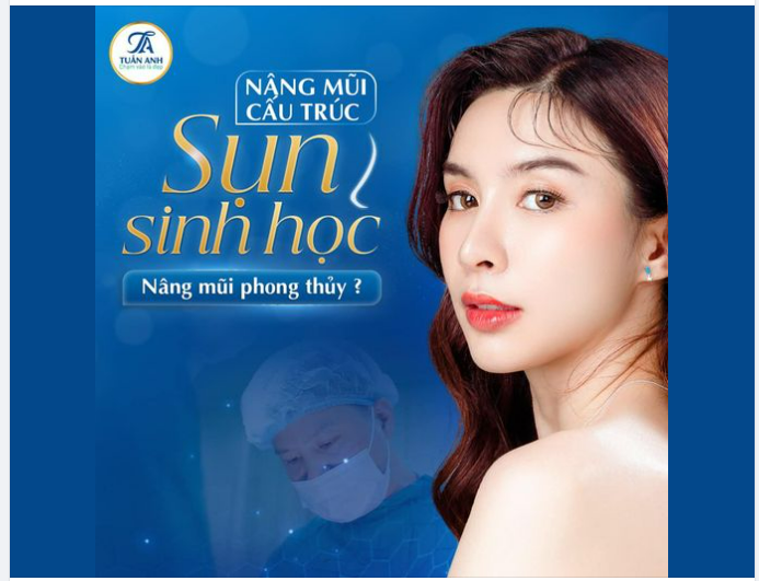 Nâng mũi cấu trúc sụn sinh học Ultra Cell