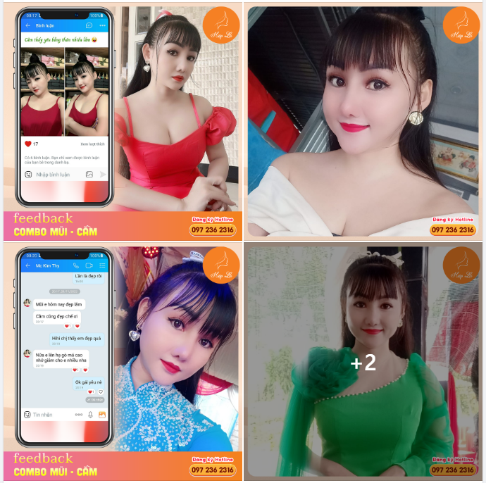 Combo Mũi - Cằm của em khách hàng nhà Hiệp Lợi cân hết mọi góc nhìn
