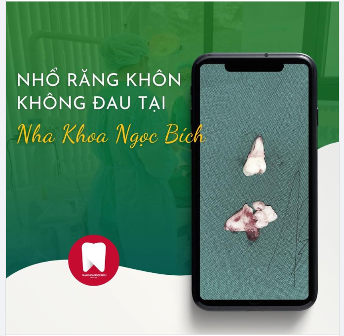 NHỔ RĂNG KHÔN KHÔNG ĐAU CÔNG NGHỆ MỚI