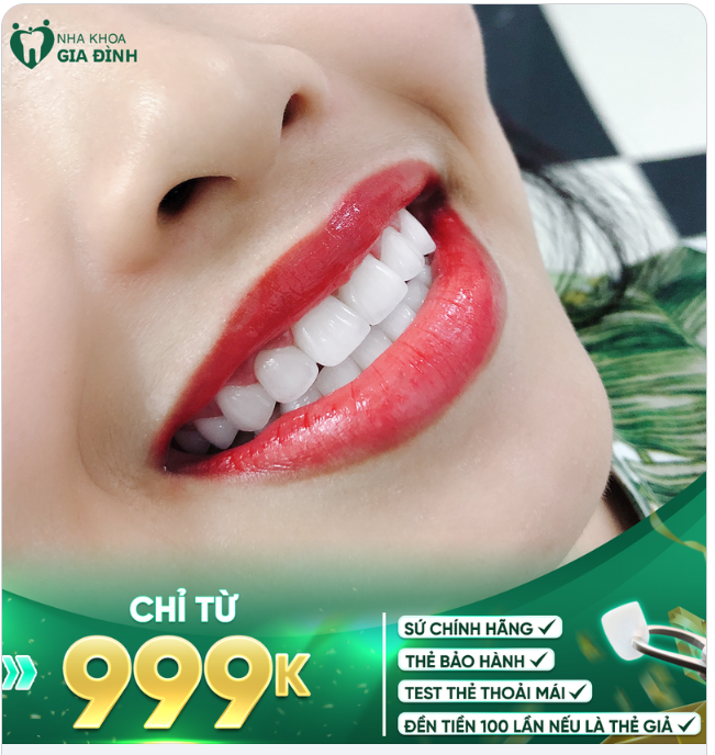 CHỈ CÒN TỪ 999K RĂNG TOÀN SỨ CHÍNH HÃNG