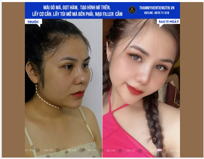 XẢ HÀNG HÌNH ĐẸP SAU BAO NGÀY CHỜ ĐỢI