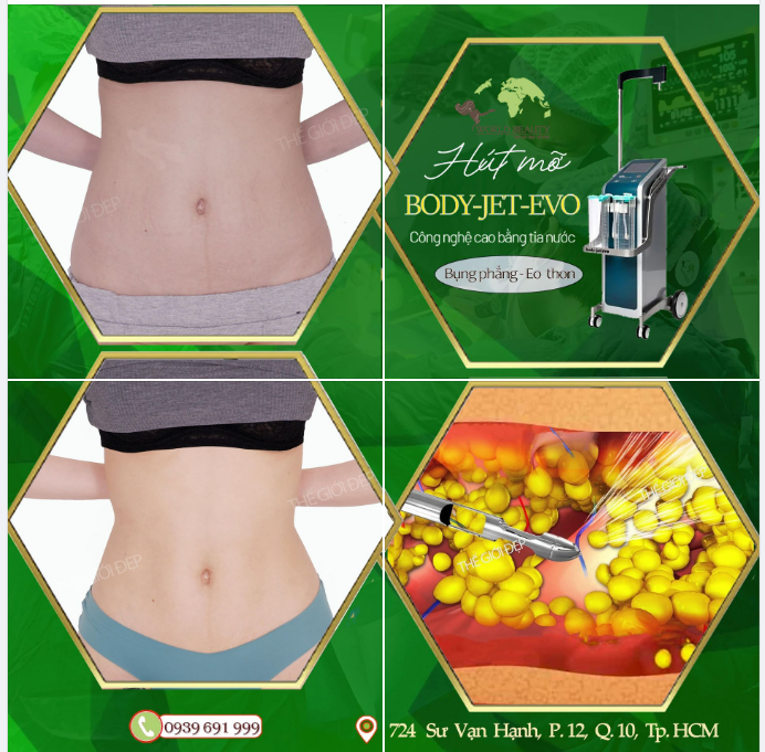 Hút mỡ Body Jet Evo - Công nghệ đột phá ưu việt trong ngành thẩm mỹ Body: