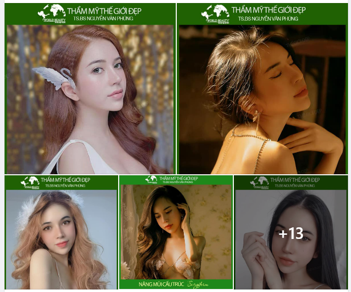 Không hài lòng với kết quả mũi từ lần thẩm mỹ trước đó. 9X tìm đến Thế Giới Đẹp và cái kết mãn nhãn sau khi Tái cấu trúc mũi Surgiform sụn tự thân.