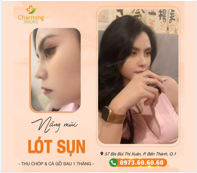 Người xinh đến thế mà chiếc mũi ban đầu lại "phá game" đủ kiểu với chóp to, gồ mũi.