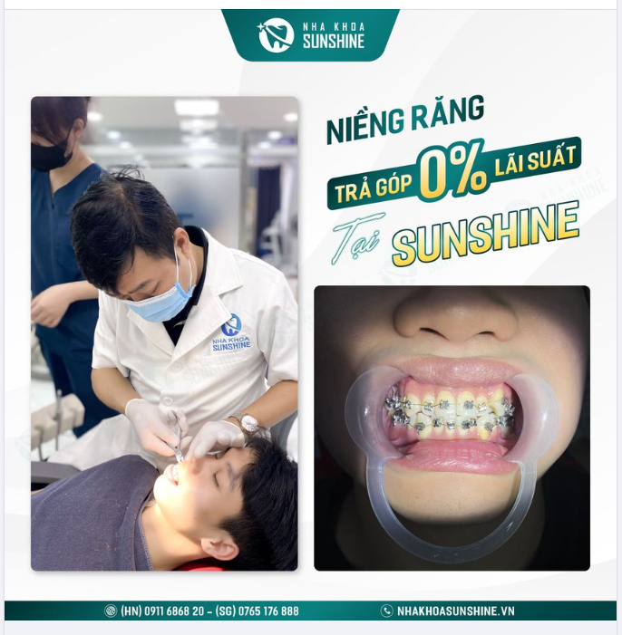 Nếu bạn muốn thay đổi hàm răng xô lệch của mình mà còn phân vân về chi phí điều trị thì  Nha khoa Thẩm mỹ Sunshine là lựa chọn tốt nhất dành cho bạn.