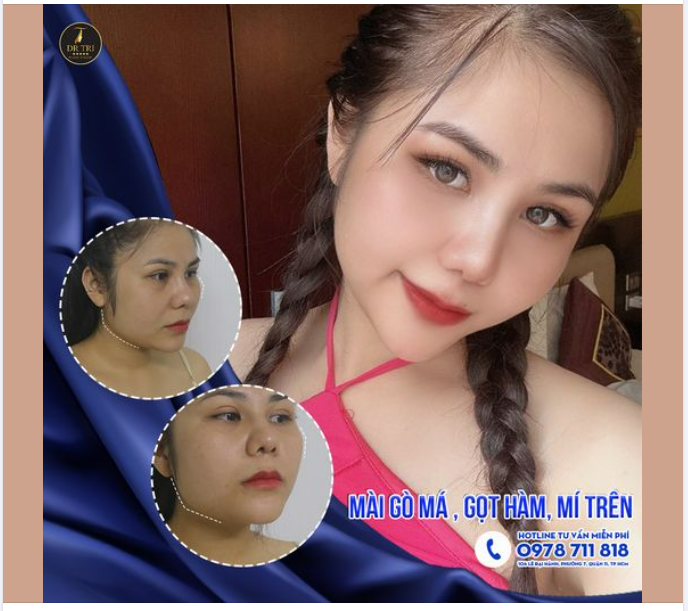 NÂNG TẦM NHAN SẮC SAU 1 THÁNG KIÊN TRÌ