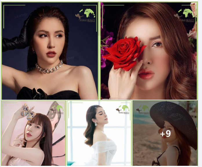 Hình ảnh quý Cô xinh đẹp sau 5  năm duy trì kết quả mũi hoàn mỹ nhờ giải pháp n.âng cấu trúc bằng sụn tự thân kết hợp sụn sinh học Surgiform tại Thế Giới Đẹp!