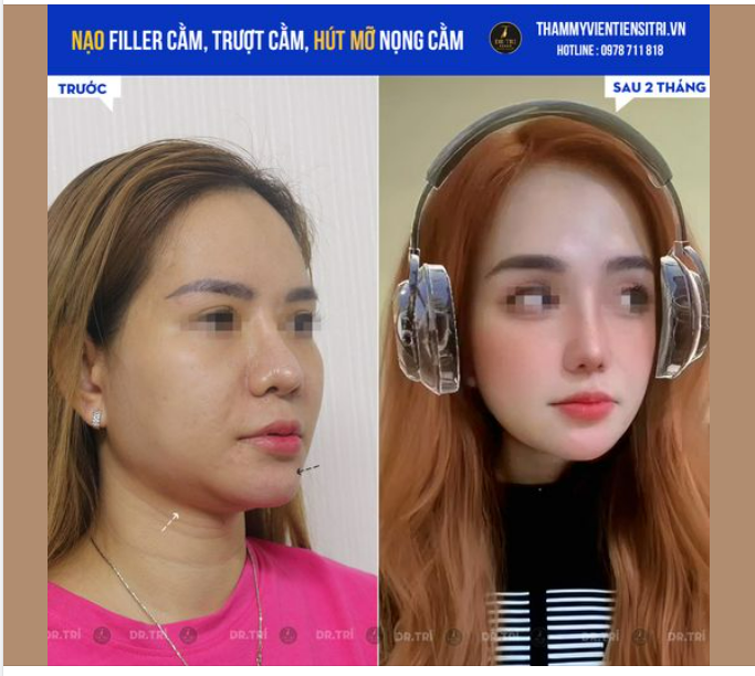 FEEDBACK HÌNH KHÁCH ĐẸP