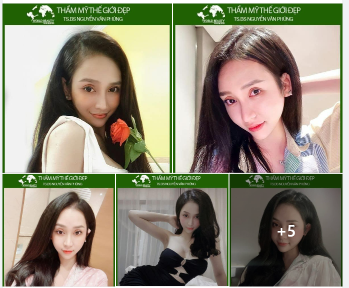 Nhiều Khách hàng lo lắng sau ph.ẫu th.uật tạo hình Nâng mũi cấu trúc liệu có làm mất đi vẻ đẹp tự nhiên vốn có của khuôn mặt không?