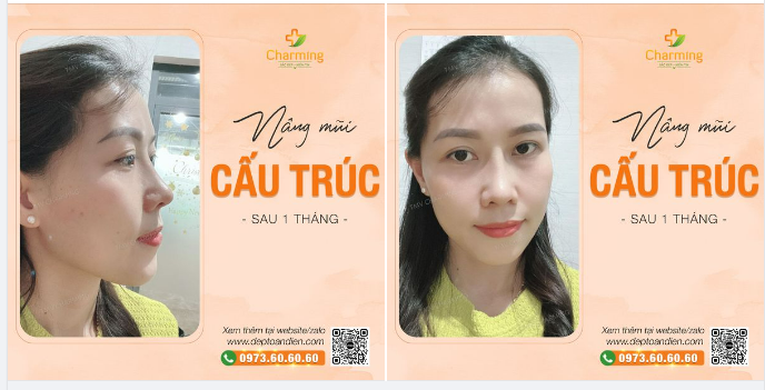 Nếu trời không có nắng, anh chỉ cần có em, Vì em luôn tỏa sáng, và luôn là mặt trời trong anh