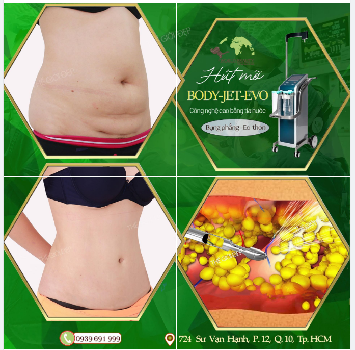 Không cần phải kỳ công giảm m.ỡ bằng những bài tập thường ngày thay vào đó chỉ sau 1 lần hút m.ỡ tạo E.o bằng công nghệ Body Jet Evo: