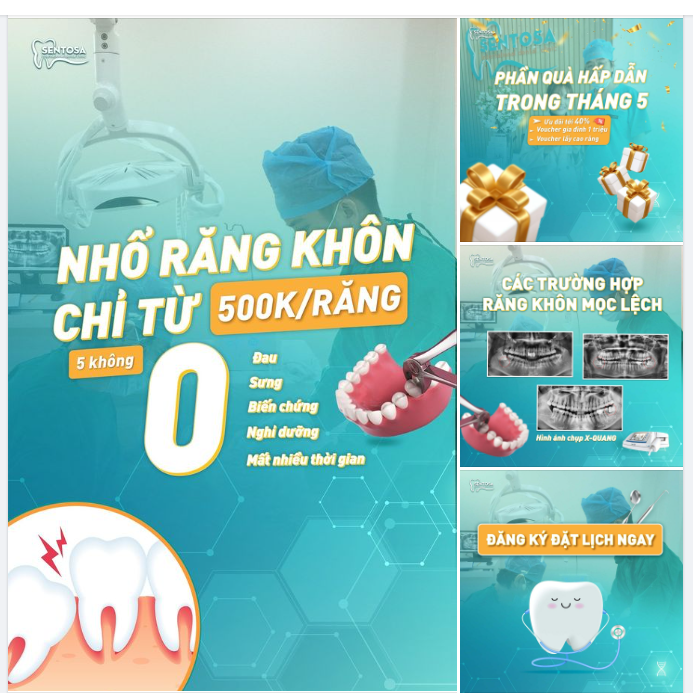 NHỔ RĂNG KHÔN CHỈ TỪ 500K/RĂNG NHANH CHÓNG, NHẸ NHÀNG ĐẾN BẤT NGỜ