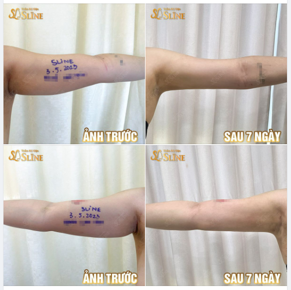 Nhận ưu đãi giảm đến 30% khi chọn combo 2 dịch vụ!