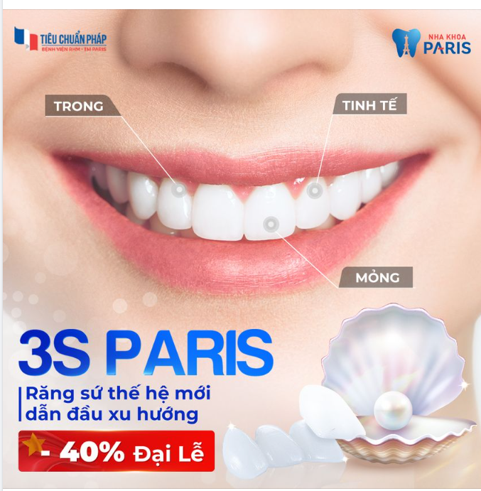 RĂNG SỨ 3S PARIS DẪN ĐẦU XU HƯỚNG
