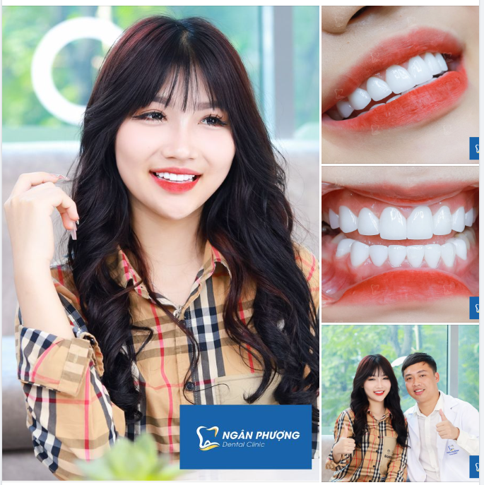 Nổi tiếng trần gian một đóa Trà  Dịu dàng, xinh đẹp nét kiêu sa