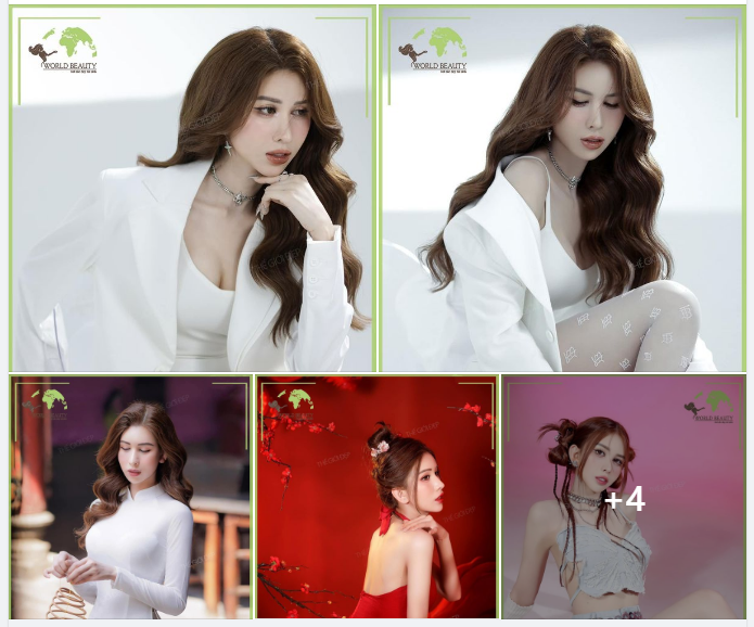 Sau 2 lần nâng cấp mũi không vừa ý, quý Cô tìm đến Thế Giới Đẹp với lựa chọn combo tái cấu trúc mũi bằng sụn tự thân và n.âng cằm bằng sụn sinh học Surgiform.