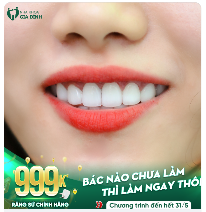CƠ HỘI CỰC TỐT CHO NHỮNG AI CHƯA LÀM RĂNG THẨM MỸ