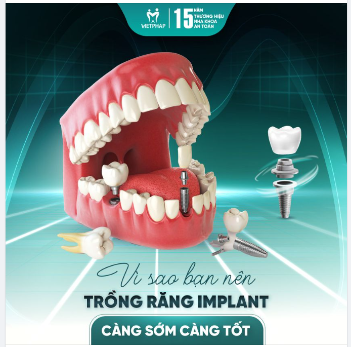 VÌ SAO BẠN NÊN TRỒNG RĂNG IMPLANT CÀNG SỚM CÀNG TỐT