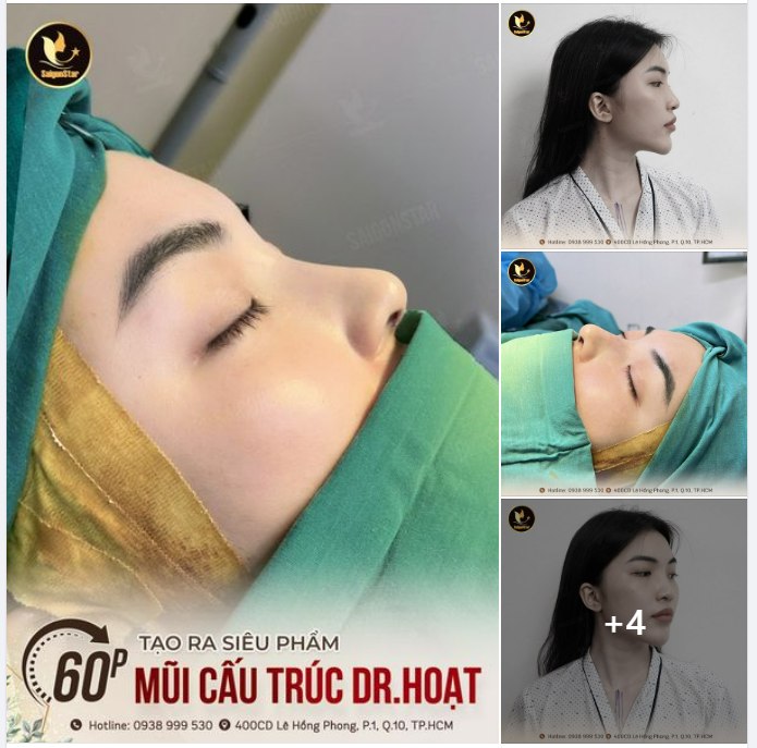 60 PHÚT TẠO RA SIÊU PHẨM MŨI CẤU TRÚC DR. HOẠT