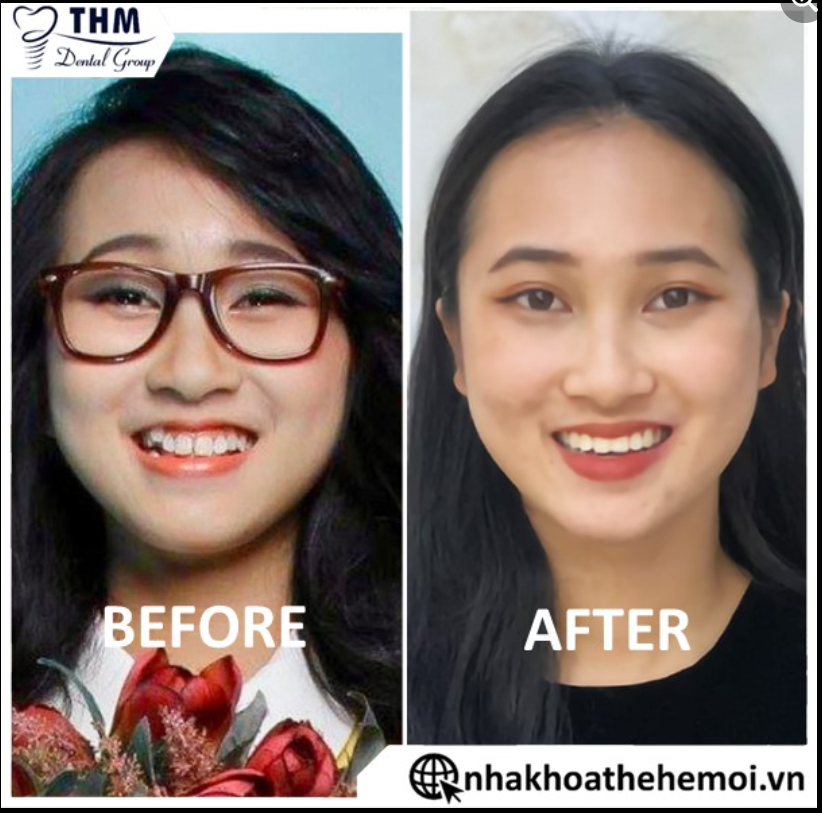 CHÚC MỪNG KHÁCH HÀNG THÁO NIỀNG