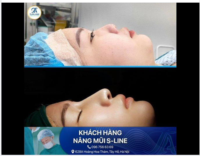 SIÊU PHẨM S-LINE KIẾN TẠO GÓC NGHIÊNG ĐẸP MÊ