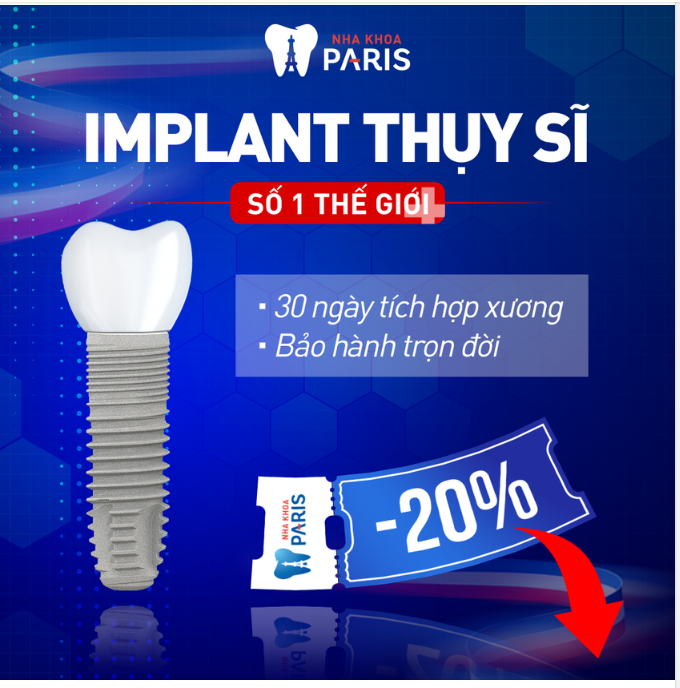 IMPLANT THỤY SĨ - LỰA CHỌN HÀNG ĐẦU CỦA CHUYÊN GIA