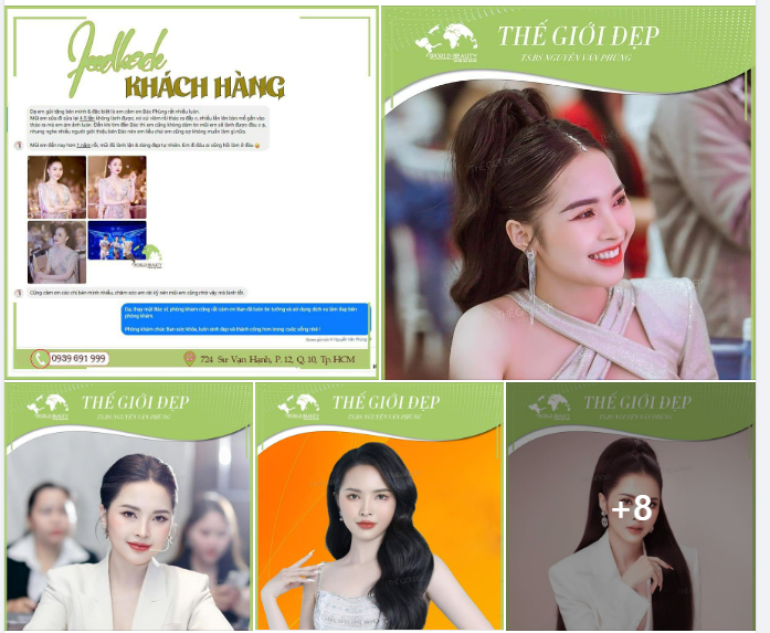 Sau lần liều thứ ​​​​​​​6 quý Cô đã mỹ mãn với lần tái ph.ẫu thuật bằng sụn tự thân kết hợp thanh Surgiform tại Thế Giới Đẹp.