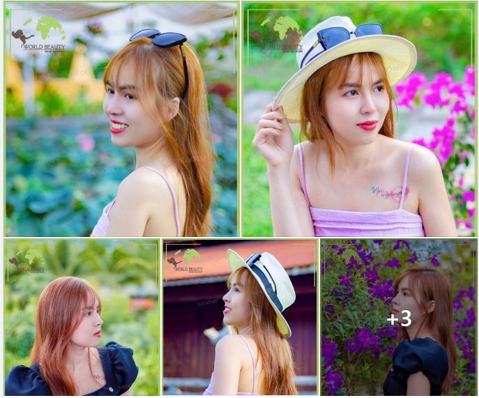 9 X lột xác ngay sau lần đầu tiên tìm đến Thế Giới Đẹp nâng mũi cấu trúc bằng sụn tự thân và thanh Surgiform