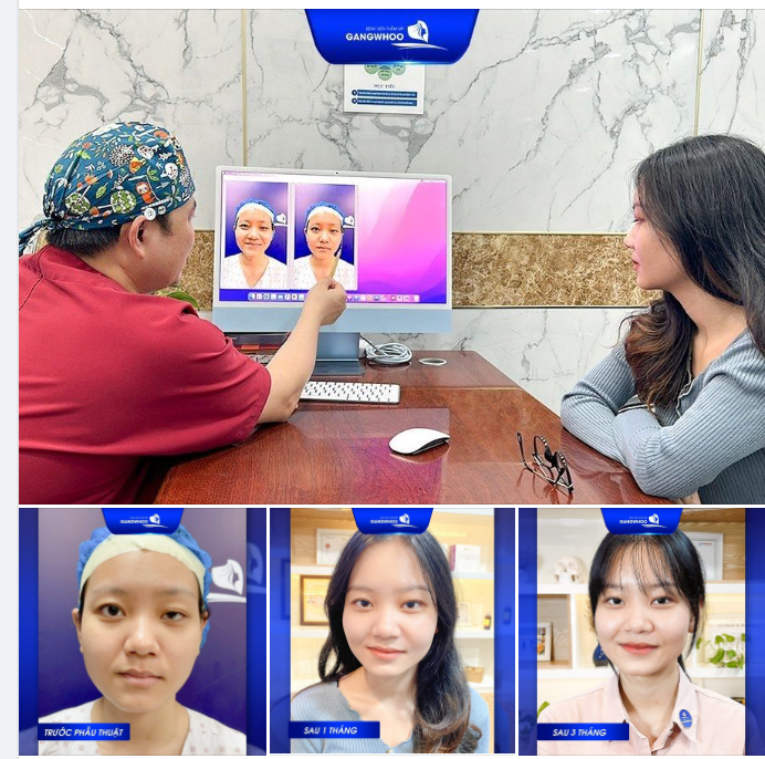 Đến Bệnh viện thẩm mỹ Gangwhoo, khách hàng được đội ngũ BS hơn 15 năm kinh nghiệm thăm khám và tư vấn trực tiếp.