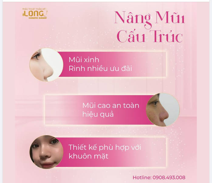 HÔM NAY ĐI NÂNG MŨI VÀ CÁI KẾT VÌ CHỌN NHẦM PHƯƠNG PHÁP
