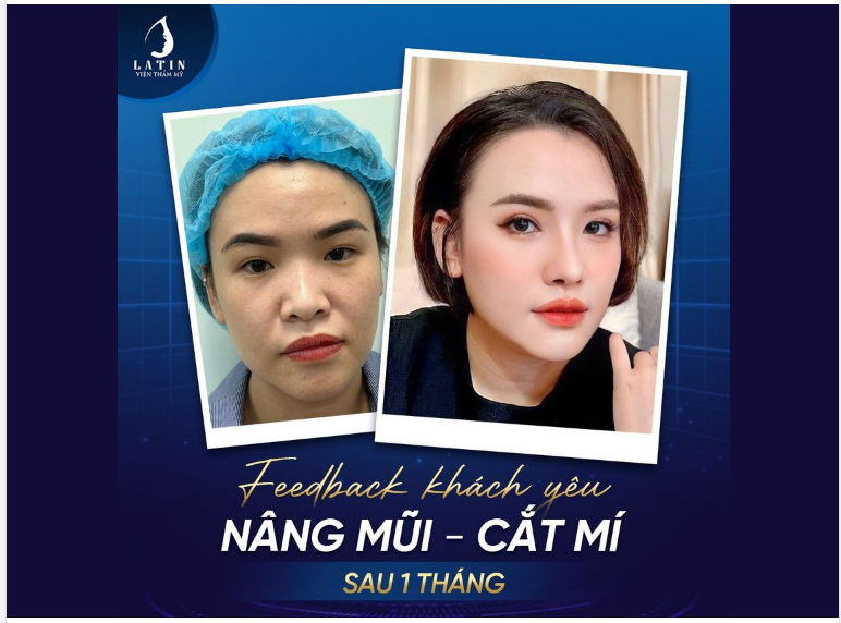 BIẾN HÌNH THÀNH CÔNG Thay đổi khuyết điểm để tự tin hơn