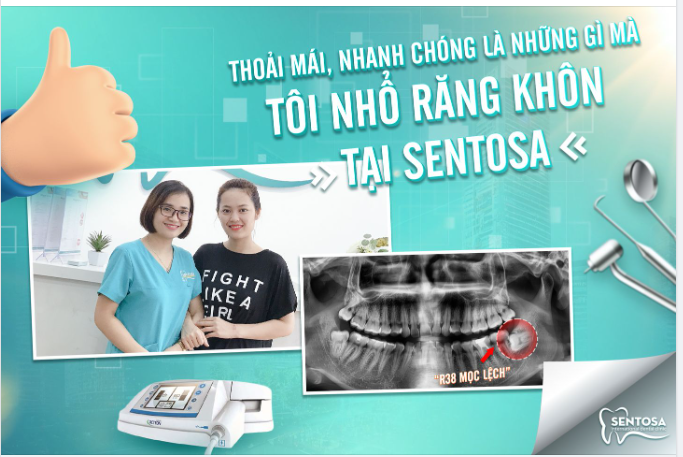 “THOẢI MÁI, NHANH CHÓNG LÀ NHỮNG GÌ MÀ TÔI NHỔ RĂNG KHÔN TẠI SENTOSA”
