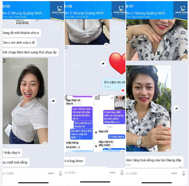 Chị Nhung là một trong những khách hàng kỹ tính và khó tính nhất mà nha khoa từng đón tiếp.