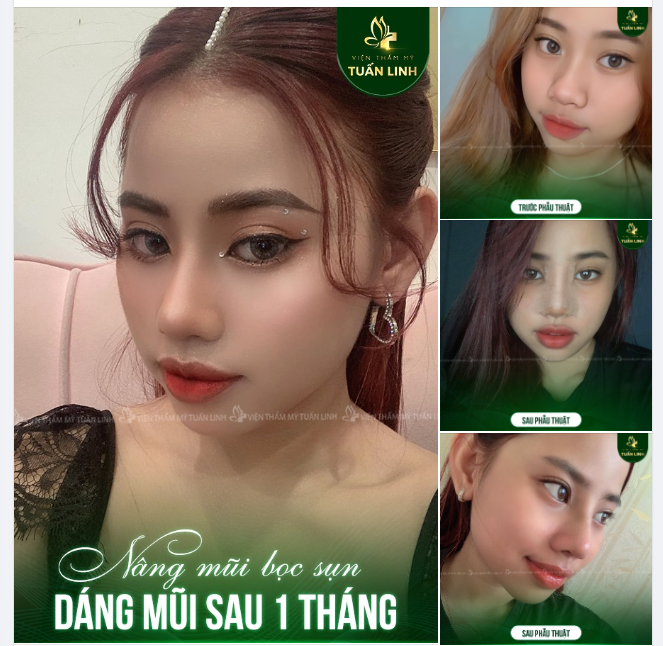 Cô nàng K.P và bước ngoặt nhan sắc khi gửi gắm niềm tin tại Tuấn Linh!