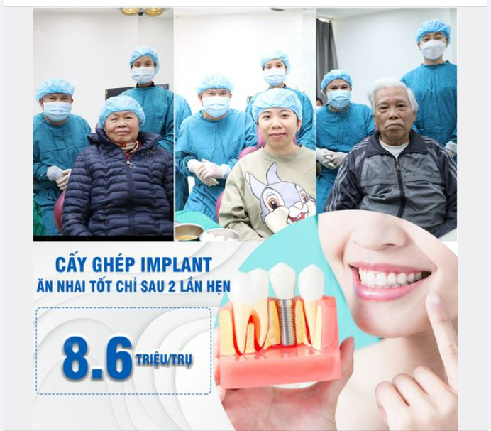 CẤY GHÉP IMPLANT - LỰA CHỌN HÀNG ĐẦU CHO RĂNG BỊ MẤT