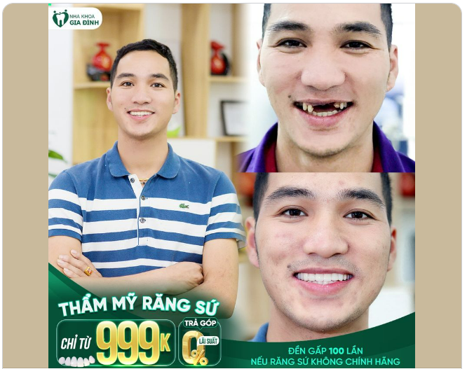 NGÀY VUI SƯỚNG NHẤT CHÍNH LÀ NGÀY NÀY - NGÀY CÓ ĐƯỢC HÀM RĂNG TRẮNG SÁNG