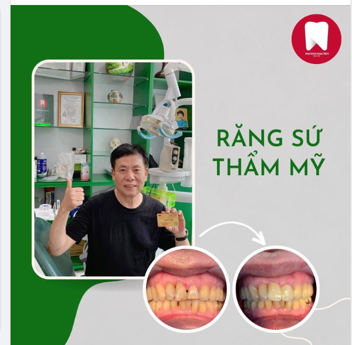 THÀNH CÔNG TÌM LẠI NỤ CƯỜI TỰ TIN CHO NAM KHÁCH HÀNG TRUNG NIÊN CÙNG RĂNG SỨ THẨM MỸ