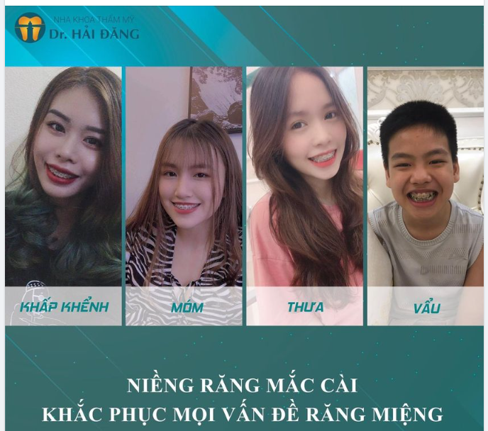 NIỀNG RĂNG Ở ĐỘ TUỔI NÀO THÍCH HỢP  NHẤT ?