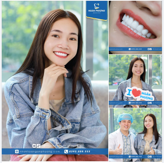 Nụ cười đẹp khiến nha khoa không tìm được từ nào để diễn tả. Bên ngoài, chị Lan còn cười đẹp hơn lên hình rất nhiều.