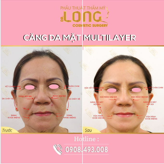 TRẺ HÓA CHUYÊN SÂU - CHỮA LÀNH TUỔI TÁC