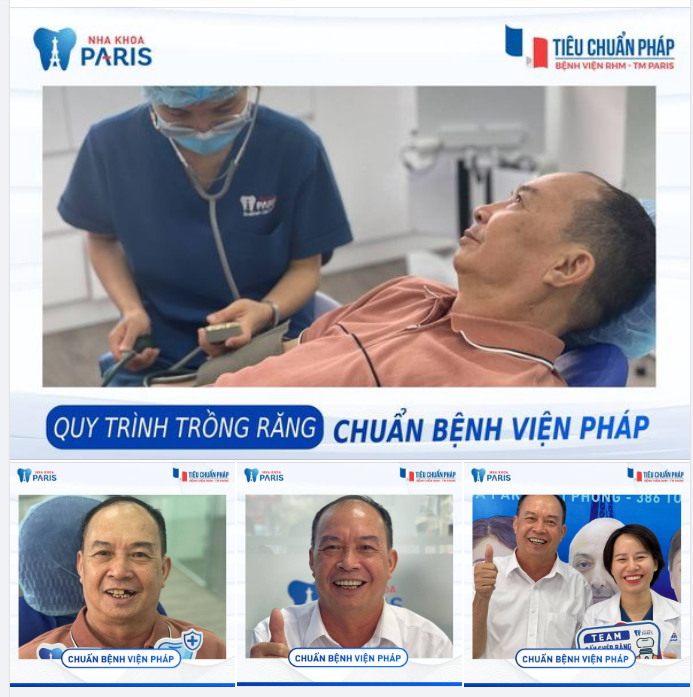 QUY TRÌNH TRỒNG RĂNG CHUẨN BỆNH VIỆN PHÁP