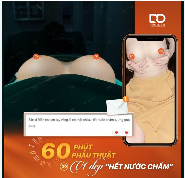 Trước đó khách hàng sở hữu V1 nhỏ lép nhưng vì sợ đau nên chần chừ mãi mới quyết tâm để thực hiện phẫu thuật.