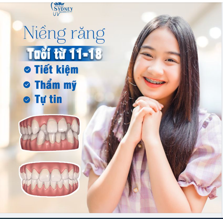 NIỀNG RĂNG ĐỘ TUỔI “VÀNG” – ĐÚNG THỜI ĐIỂM, HIỆU QUẢ CAO