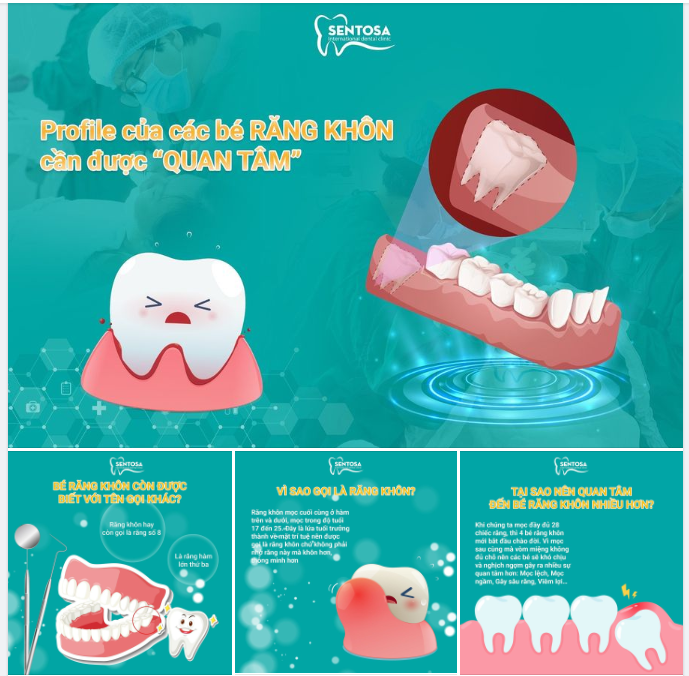 PROFILE CỦA BÉ RĂNG KHÔN CHẤT NHƯ THẾ NÀO?!!!!