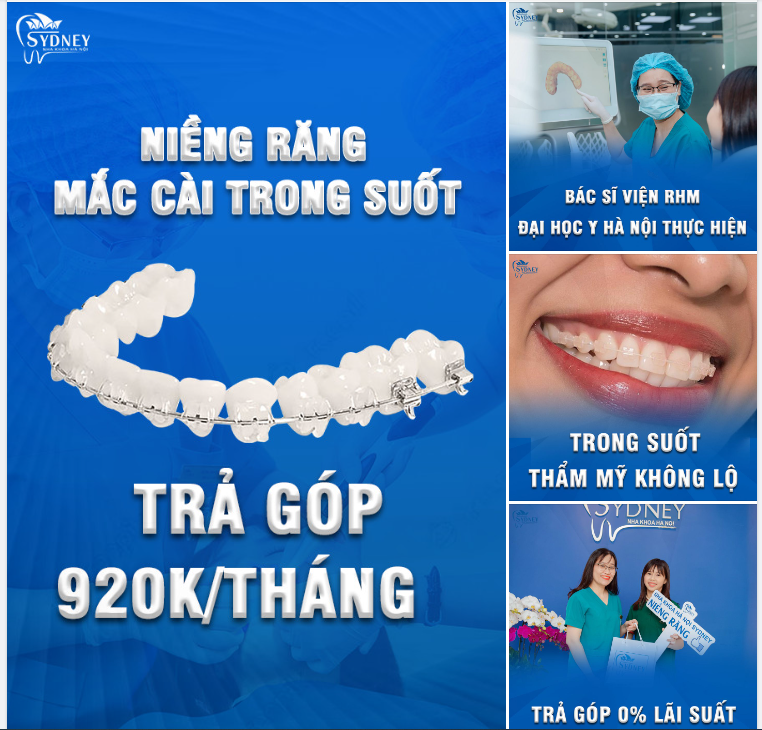 LÍ DO BẠN NÊN CHỌN NIỀNG RĂNG MẮC CÀI TRONG SUỐT NGAY HÔM NAY!
