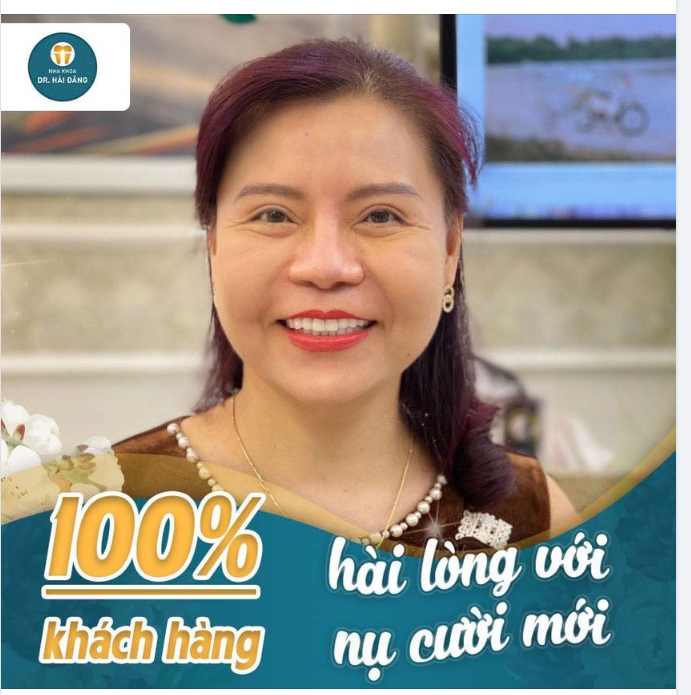 BỌC RĂNG SỨ GÌN GIỮ NÉT THANH XUÂN
