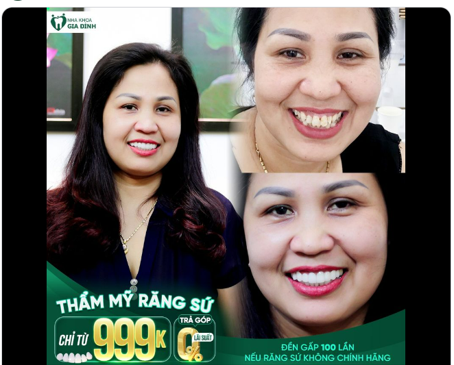 Bạn nghĩ thật khó tìm được một đơn vị nha khoa uy tín có giá cả phải chăng và đảm bảo chất lượng.
