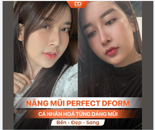 MŨI CÓ KHUYẾT ĐIỂM NÀO, SỬA NGAY KHUYẾT ĐIỂM ĐÓ