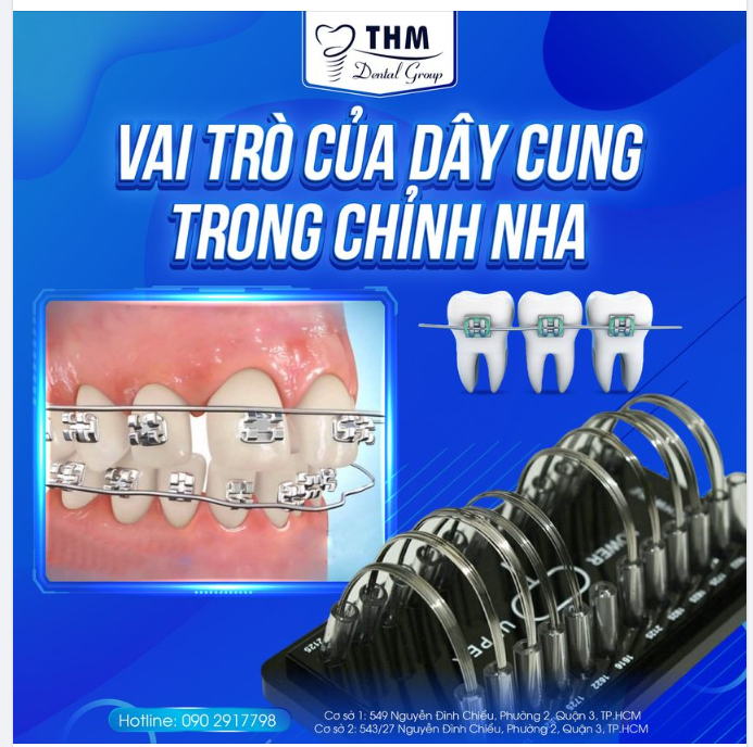 VAI TRÒ CỦA DÂY CUNG TRONG CHỈNH NHA